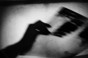 tuberkuloz-aa-1674098