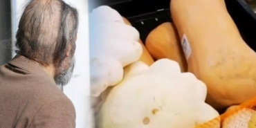 kabak-pisirip-yedi-basina-gelmeyen-kalmadi-zehirli-oldugunu-ogrenince-soke-oldu-3212559_202504081528_2