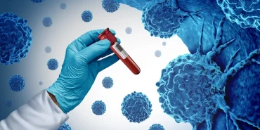 kanser-nedir-tani-ve-tedavi-yontemleri-9204984