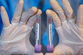 hanta-virus-2459282