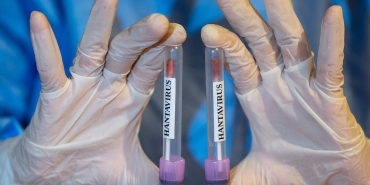 hanta-virus-2459282