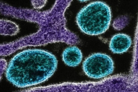 nipah-virusu-getty-2107428
