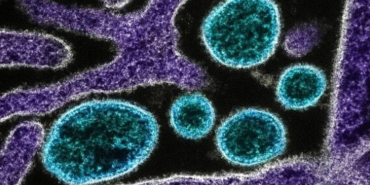 nipah-virusu-getty-2107428