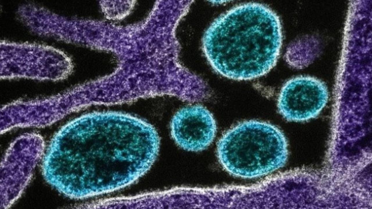 DSÖ, Atlas Okyanusu’ndaki gemide 7 hantavirüs vakası belirlendiğini bildirdi